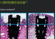 bone区别 bornin和bornon 