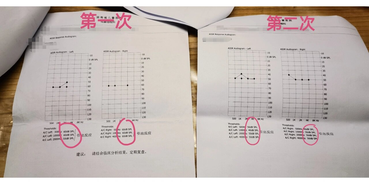 aabr和abr的区别 aabr和abr哪个更准确 