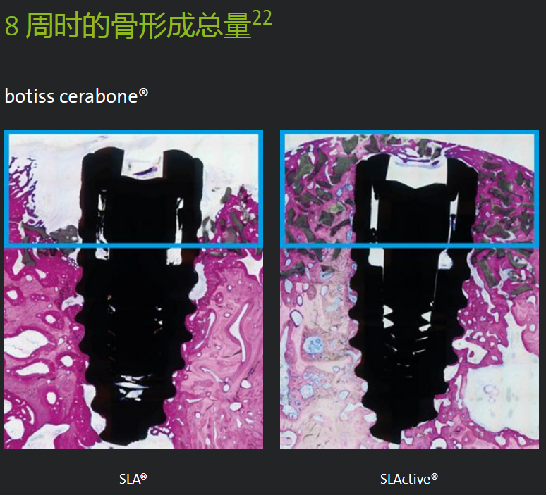 bone区别 bornin和bornon 