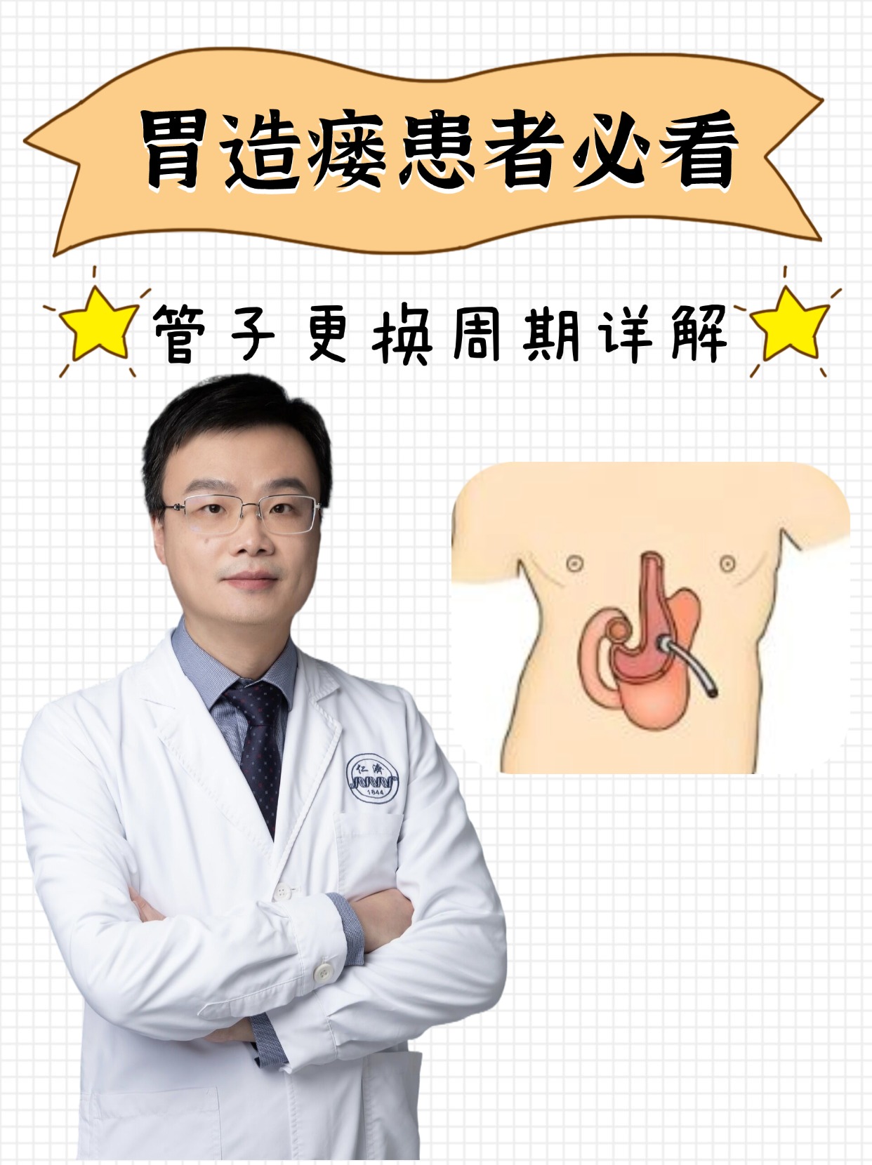 pegpci区别 pexc与pert 