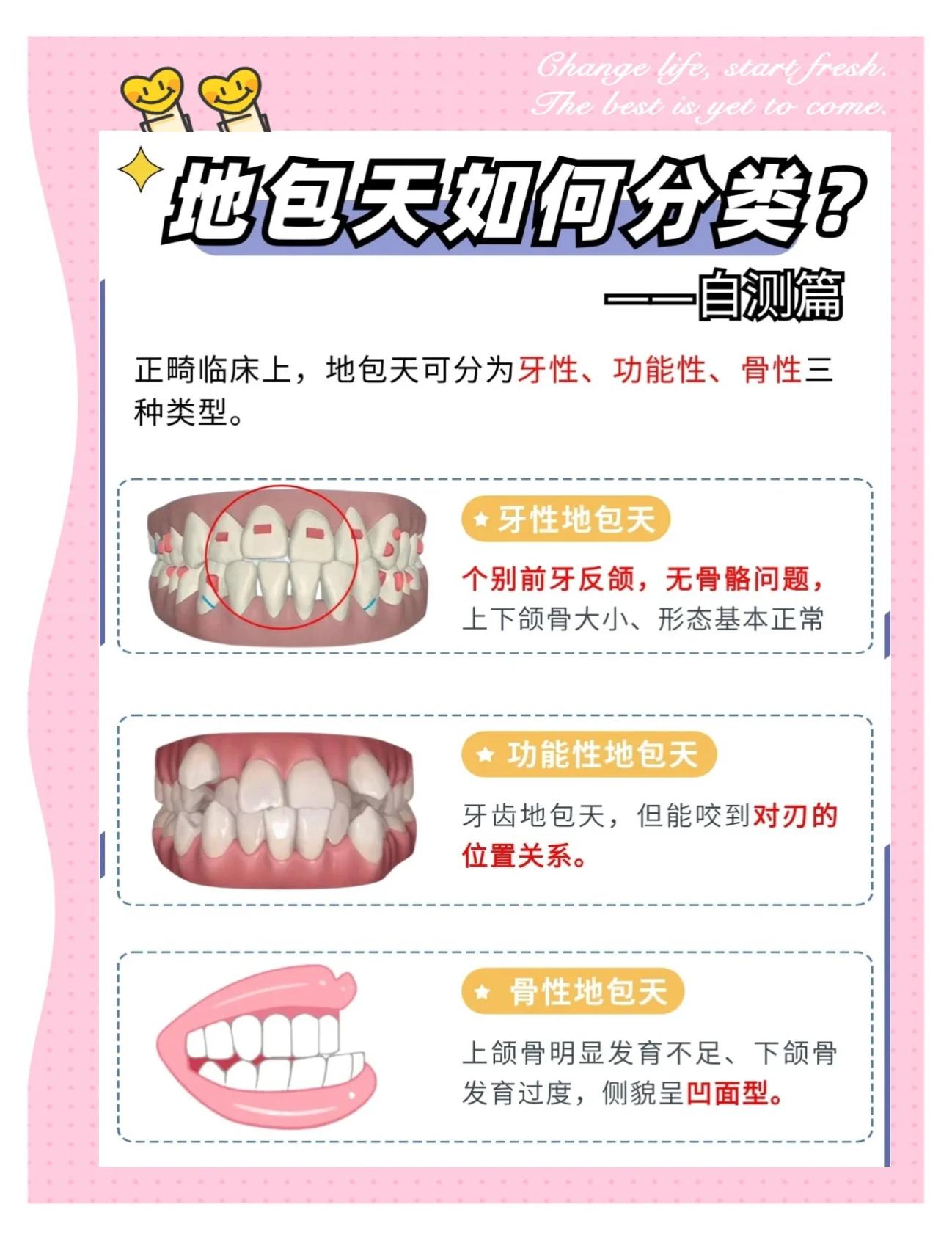 凸锥凸包区别 锥形凸台的体积公式 